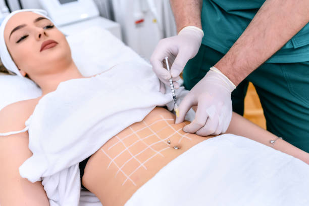 liposucción en León