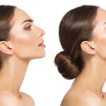 Cirugía de nariz en León