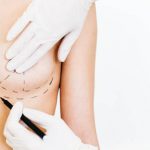 aumento de mama en León