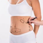 ¿Debería elegir lipoabdominoplastia o la técnica tradicional? Descubra qué necesita para eliminar flancos y flacidez. Experto en abdominoplastia en León. ¡Contáctenos!