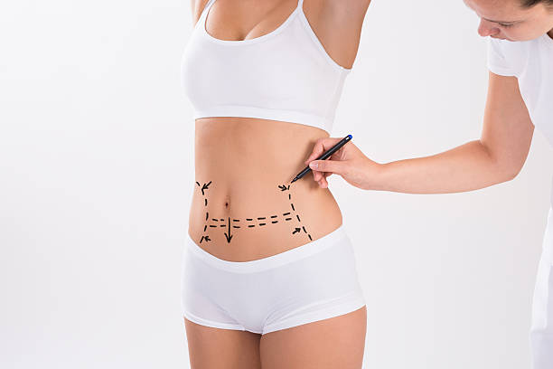¿Debería elegir lipoabdominoplastia o la técnica tradicional? Descubra qué necesita para eliminar flancos y flacidez. Experto en abdominoplastia en León. ¡Contáctenos!