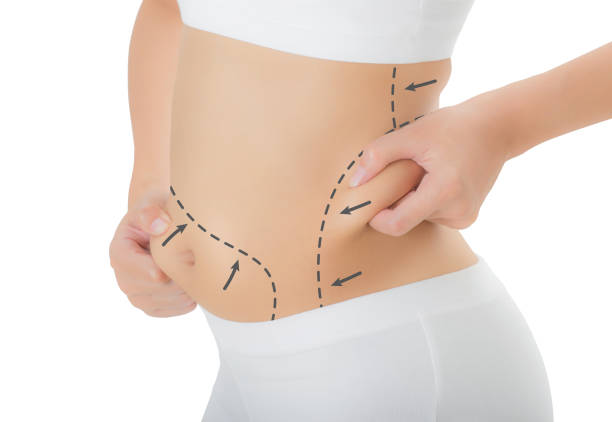 abdomen fácido