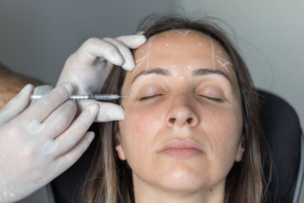 inyección de bótox en el rostro
