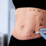 abdomen de mujer