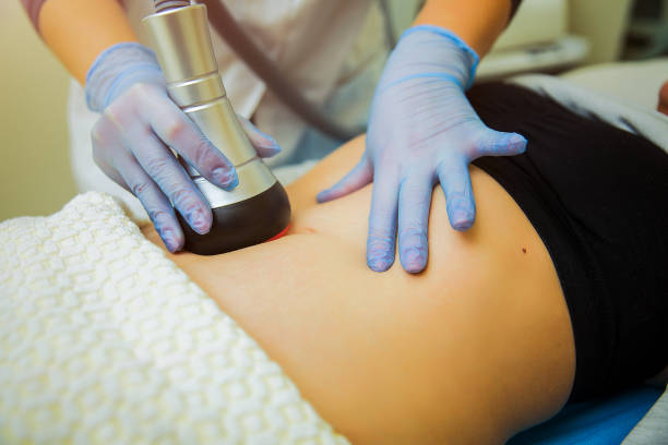 mujer recibiendo tratamiento de bodytite