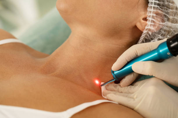 mujer recibiendo tratamiento en cuello