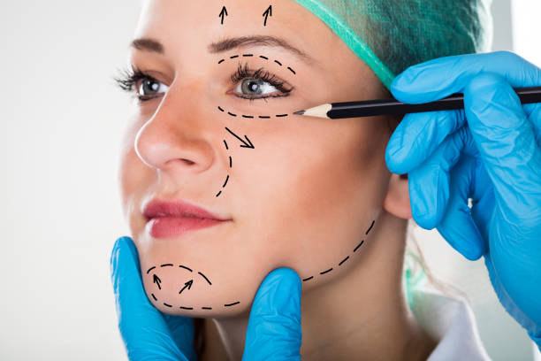 mujer con marcas en el rostro