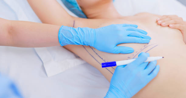 médico poniendo marcas en pecho de mujer